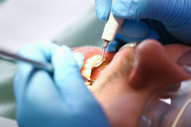 Best Emergency Root Canal Treatment in Cambridge, IL